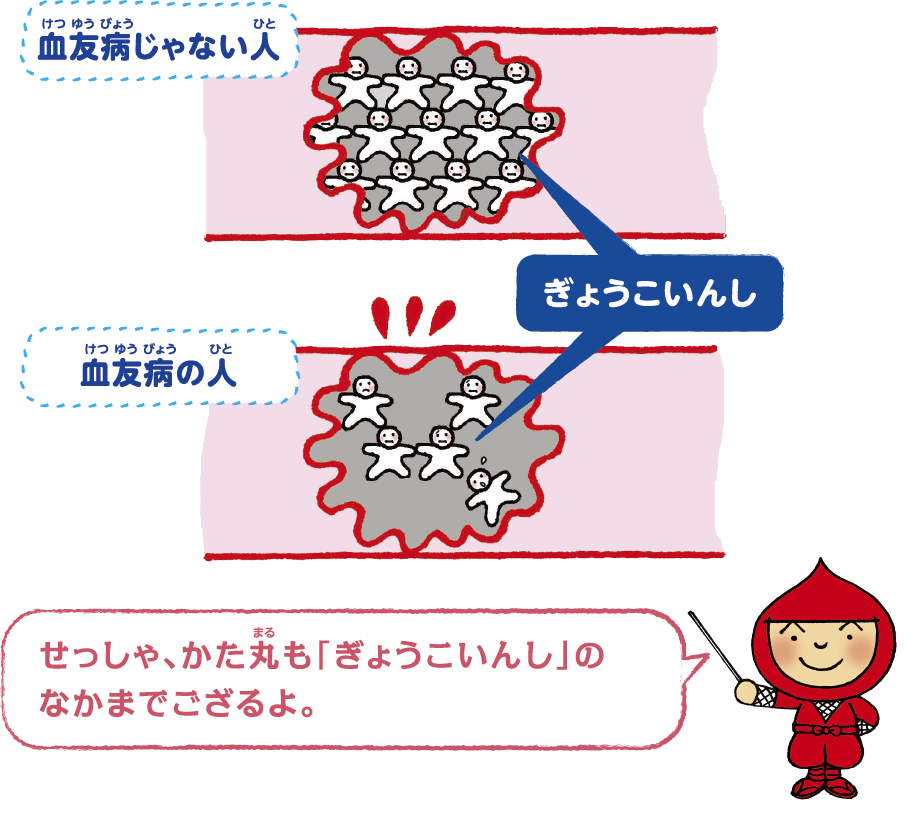 どうして血が止まりにくいの?